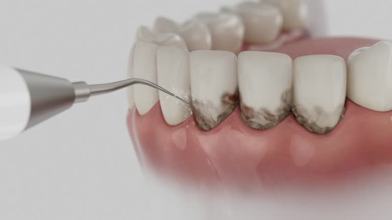Trusted Dental Crowns And Bridges service in Duryea, PA - Dentist Open Now